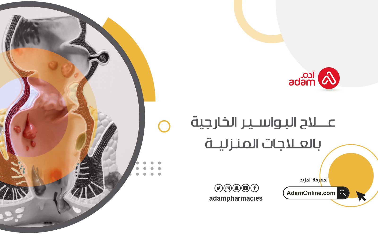 Treatment of external hemorrhoids with home remedies